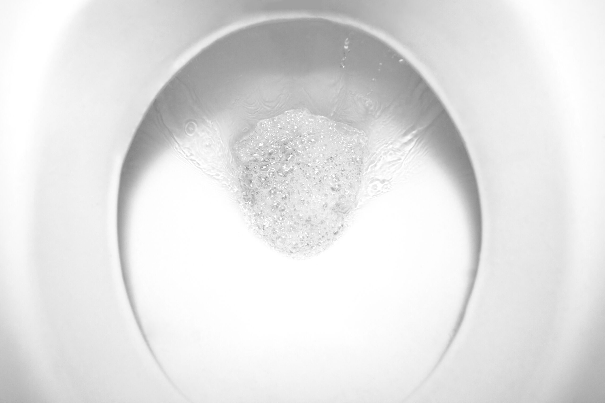 Toilet Not Flushing Right? Toilet Fix in Chula Vista